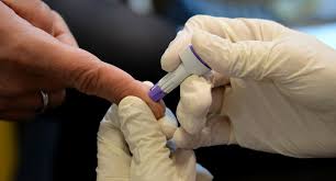 Es kann auch die viruslast (pcr) bestimmt werden. Hiv Im Zweifel Lieber Testen Baden Wurttemberg De