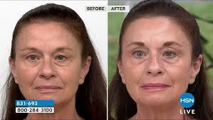 500 Before and After Weight Loss Pictures! Amazing!