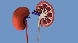 Jj Stent Removal Of Kidney Stones Youtube