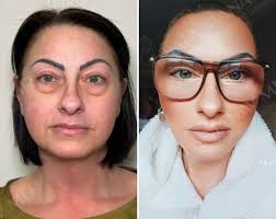 Dr. Dr Safa Manav Md