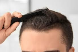 But for the average joes who don't wear it so well, there are some answers to fix the dreaded receding hairline. How To Stop A Receding Hairline And Regrow Hair 2021 Guide