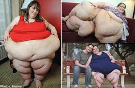 Pin On Fattest Person On Earth