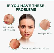 Ellen Ella Cica Oil Skin Savior Essence Toner 80ml