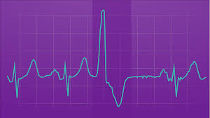 Symptoms can be subtle and not overly painful—and women's symptoms may differ. Premature Ventricular Contractions Pvc Treatments Symptoms