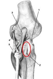 Image result for Segond Fracture
