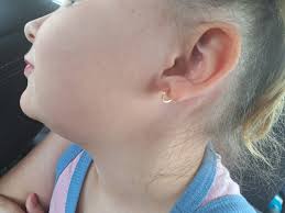 DIMPLED EARLOBE PEOPLE