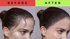 The use of nutraceuticals such as collagen for skincare has been rising, but regulations are lacking on quality, absorption, and efficacy. 5 Best Collagen That Helps Hair Growth