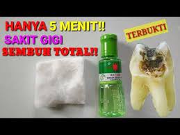Cara Mengobati Sakit Gigi Berlubang Obat Sakit Gigi Berlubang Paling Ampuh Youtube Kesehatan Alami Gigi Kesehatan