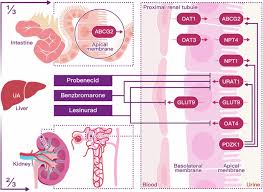 Image result for Hyperuricemia