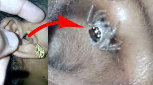 Im verein registrieren wir, dass sich bei einer wachsenden anzahl von menschen parasiten im gesamten körper ausgebreitet haben. Parasiten Und Andere Tiere Im Menschlichen Korper News Ausland Bild De