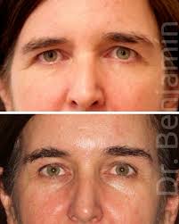 Dr. Benjamín Riesco