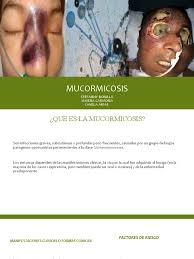 Los mucorales presentes en el ambiente pueden desarrollarse en la superficie de la lesión formando colonias superficiales. Mucormicosis Hongo Infeccion