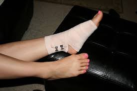 Maybe you would like to learn more about one of these? How To Treat A Sprained Ankle Sprained Ankle Treating A Sprained Ankle Sprain