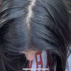 Belgravia's modern hair clinic has grown to become one of europe's largest and most renowned hair clinics, with more than 50 members of staff. Gp0 Rbicqztulm