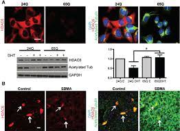 Acetylated Tubulin And Hdac6 Staining In Mn1 Cells And Human Spinal Download Scientific Diagram