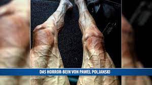 Retrouvez le parcours complet, le profil des étapes, les classements et résultats des précédentes éditions du tour de france sur l'équipe. Das Horror Bein Von Pawel Poljanski Youtube