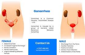 Image result for gonorrhea symptoms
