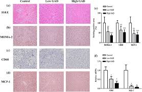 Is located in grantsboro city of north carolina state. Alleviation Of High Fat Diet Induced Atherosclerosis And Glucose Intolerance By A Novel Glp 1 Fusion Protein In Apoe Mice Springerlink