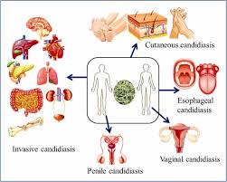 Image result for Buchnera candida