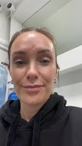 Dr Marc Mani Scar Revision