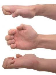 نتیجه تصویری برای ‪picture for Hand Exercise for Rheumatoid Arthritis‬‏
