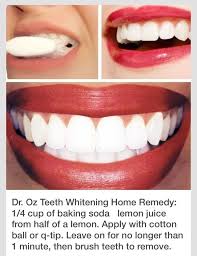 Help Whiten Teeth Baking Soda Lemon Health Beauty Diy Beauty