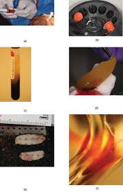Preparation protocols require revision and standardization. Platelet Rich Fibrin Utilization In The Treatment Of Periodontitis Intechopen