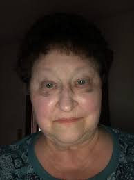 Tripped and injured face