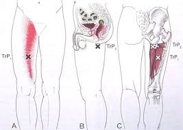 Pin On Massage