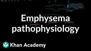 Emphysema Pathophysiology Video Khan Academy