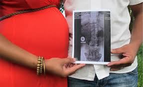 Back Pain Practical Tips For Pregnancy Myladybits