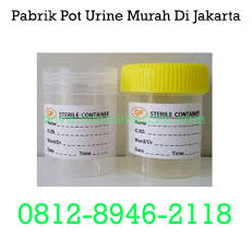 Toko alat kesehatan merupakan unit usaha yang diselenggarakan oleh perorangan atau badan untuk melakukan kegiatan pengadaan, penyimpanan berikut ini depok24jam sudah merangkum daftar toko alat kesehatan di depok yang bisa jadi rekomendasi kamu. Istana Medika