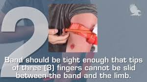 Army institute of surgical research in san the cat tourniquet gen 7 is also available in the following colors: C A T Tourniquet Generation 7 One Handed Application Youtube