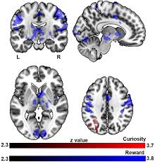 Ready to put all your random facts and bits of knowledge to use? The Main Effects Of Curiosity And Reward During Trivia Question Download Scientific Diagram