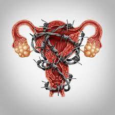 Results of a prospective, multicenter laparoscopic endometriosis surgery: Can Endometriosis Really Be That Dangerous Ulas Bozdogan Md Endometriosis Specialist