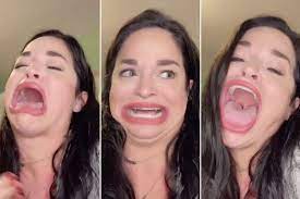 2.56 inches, she has been confirmed for sporting the world's largest mouth gape after going viral. Woman Reveals How Her Huge Mouth Made Her Tiktok Famous