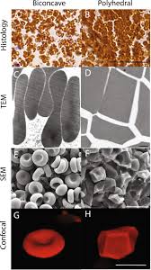 The cell is flexible and assumes a bell shape as it passes through extremely small blood vessels. Shape Changes Of Erythrocytes During Blood Clot Contraction And The Structure Of Polyhedrocytes Scientific Reports