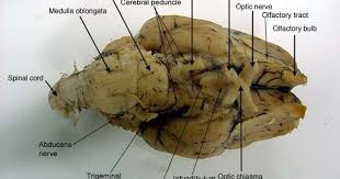 Pin By Melissa King On A P Brain Anatomy Brain Images Anatomy