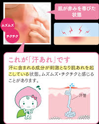 ユースキン あせも ブランドサイト｜ユースキン製薬株式会社