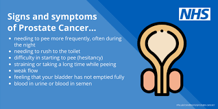 Different people have different symptoms for prostate cancer. Possible Symptoms Sandwell And West Birmingham Nhs Trust Facebook