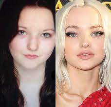 See more of dove cameron on facebook. Did Dove Cameron Get Surgery Lipstick Alley