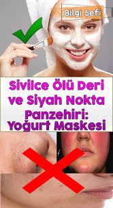 Sivilce Olu Deri Ve Siyah Nokta Panzehiri Yogurt Maskesi Siyah Noktalar Deri Bilgi