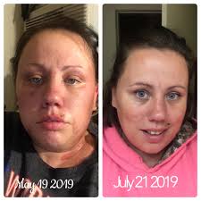 Good skincare makes you glow. ✨ I typically use my cleanser, climate  control, spot