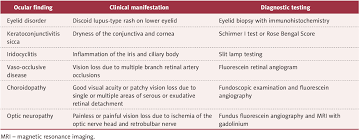 Image result for Acute Vision Loss