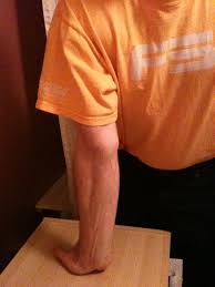 These golfer's elbow stretches and. The Cure For Golfers Elbow Medial Epicondylitis Property Investments Landlording Crossfit Nutrition Health And Safety