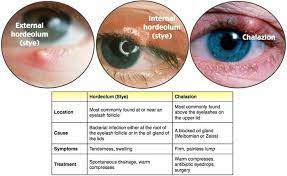Pin By Janice Hodge On Ear Nose And Throat Medical Knowledge Eye Health Facts Emergency Medicine