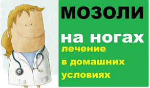 как избавиться от мозолей на ступнях в домашних условиях Mozoli Na Nogah Eto Rasprostranennaya Problema Kotoraya Ne Predstavlyaet Ugrozy Zdorovyu Cheloveka No Prichinyaet Fizicheskij I Moralnyj Disko Zdorove Vrachi Rak