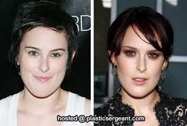 Plastic Surgery Sydney & Anti-Ageing Advice