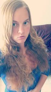 Fundraiser by Chelsea-brie McElveen : Impacted wisdom teeth