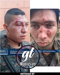 NoticiasGT ¡LAMENTABLE! SOLDADOS GUATEMALTECOS RESULTAN HERIDOS POR  HONDUREÑOS Soldados de Guatemala son atendidos luego de resultar heridos  esto producto de la caravana de migrantes hondureños en el País. · Noticias  GT · Facebook